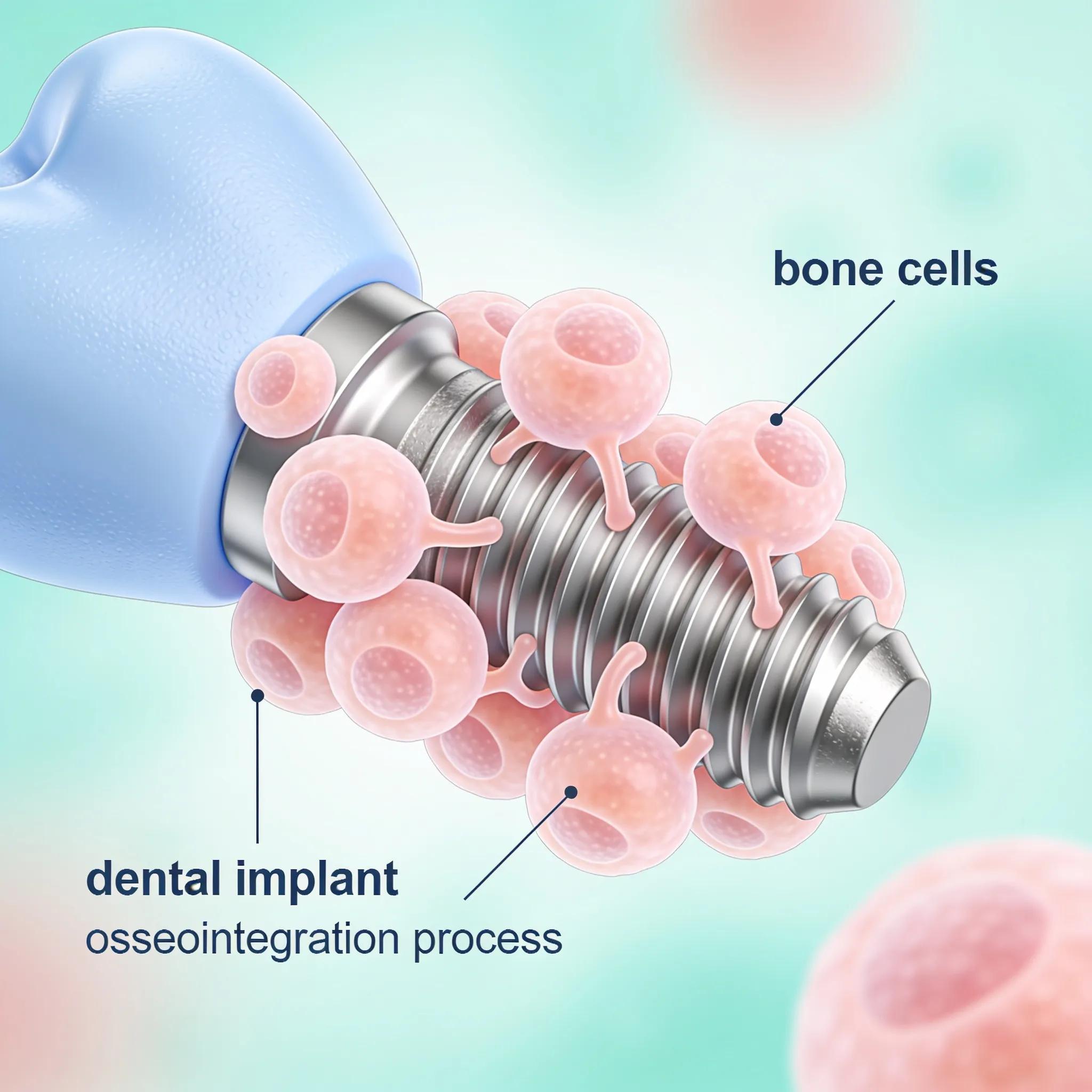 Illustration of the osseointegration process showing interaction between bone cells and an implant