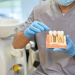 Dental Implants in Dallas