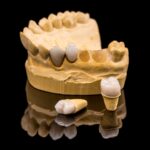 Dental Crowns in Longview