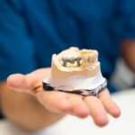Dental Crowns in Tyler