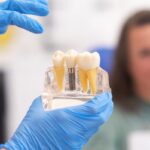 Dental Implants in Fort Worth