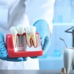 Dental Implants in Fort Worth