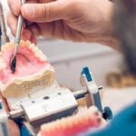 Dentures in Fort Worth