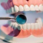Periodontal Care in Waco