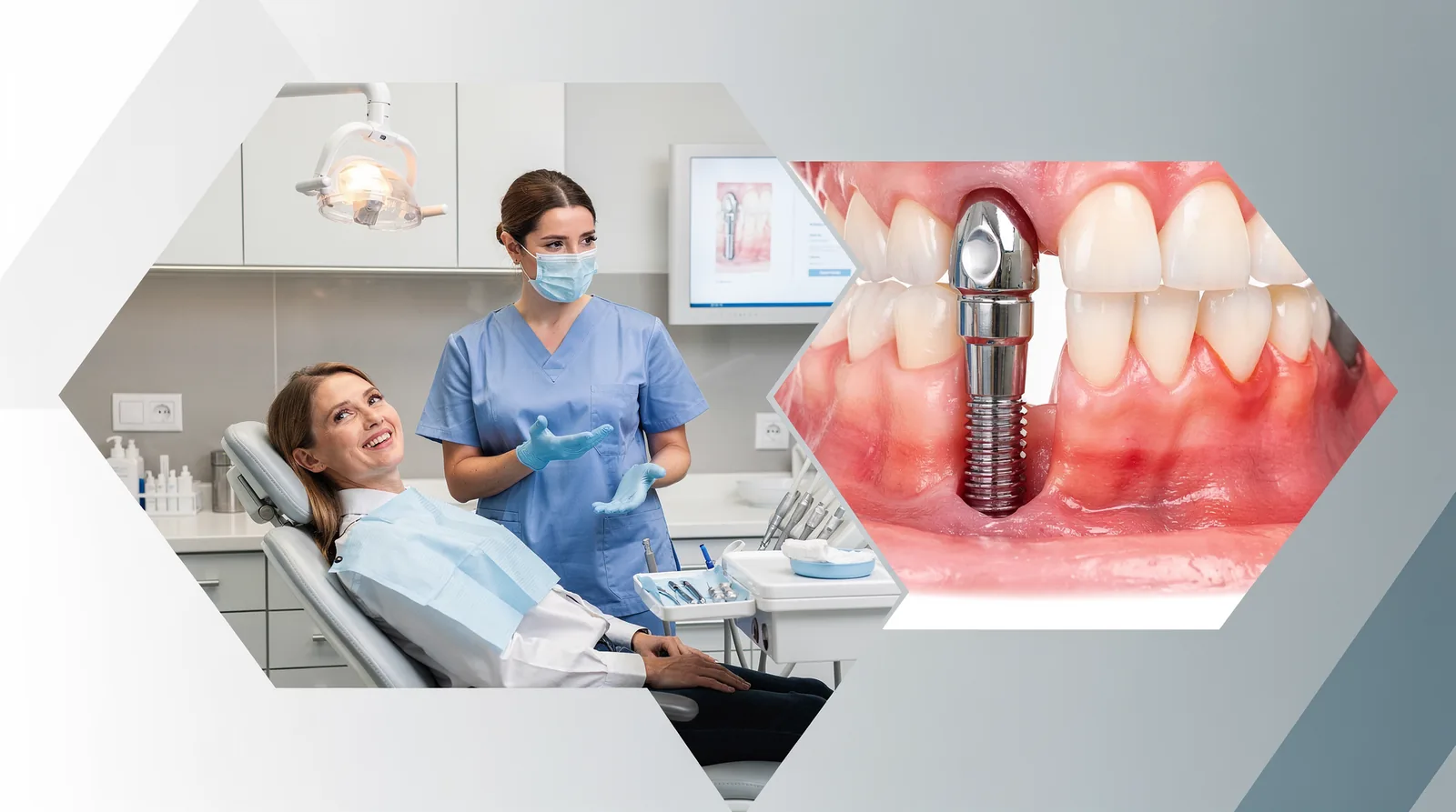 Peri-implantitis is a serious infection affecting the gum and bone around the implant.; Such infections