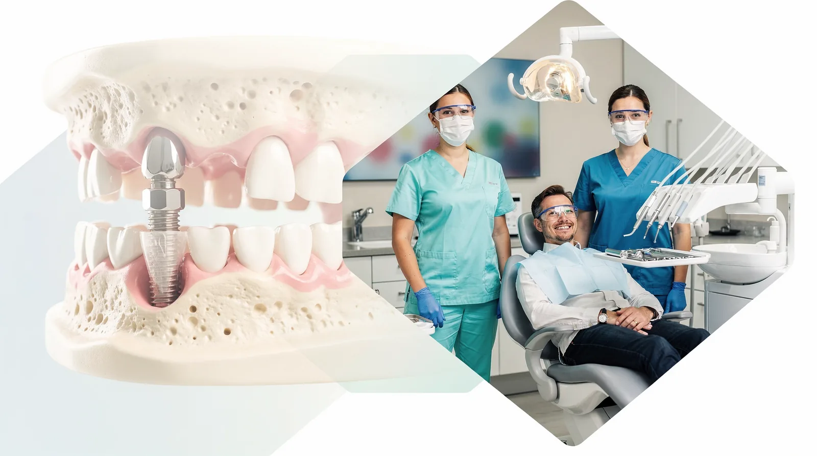 Failure of osseointegration, where the implant does not fuse properly with the jawbone