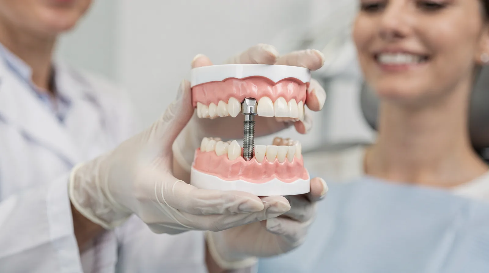 Dental implants are medical devices placed in the jaw to restore chewing ability and natural