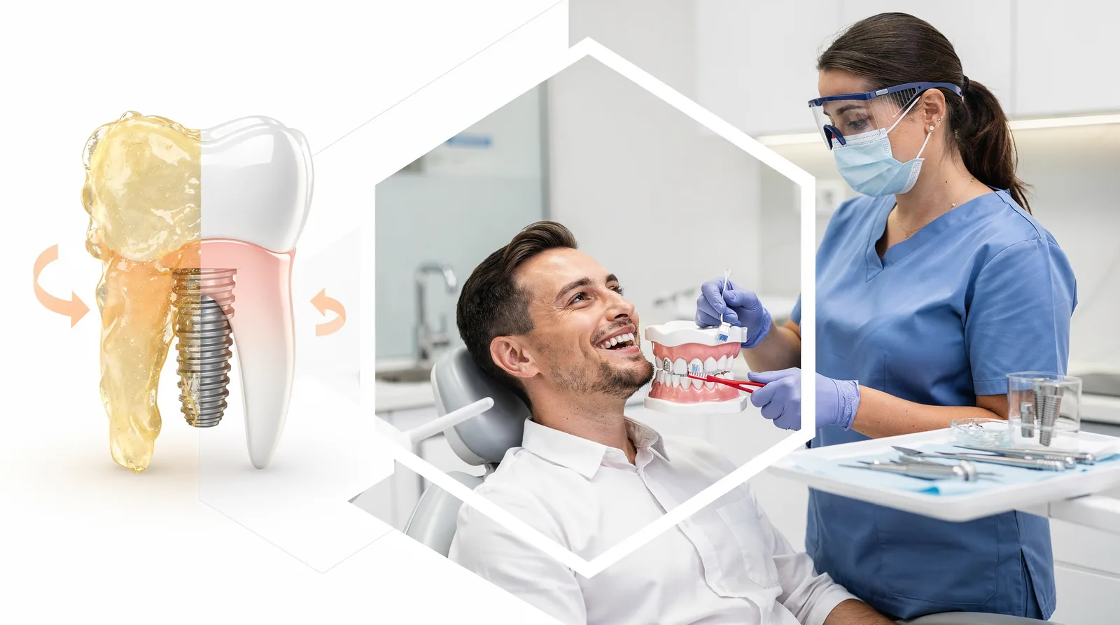 The first step in maintaining dental implants is adhering to a strict oral hygiene routine