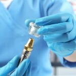 Dental Implants in Fort Worth