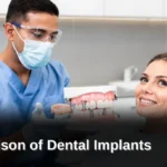 Dental implants are screw-like posts surgically placed in the jaw to support artificial teeth