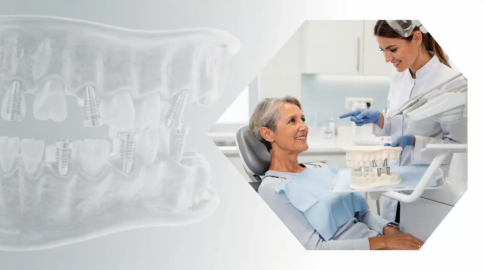 One common issue is implant instability from failed integration with the jawbone.; Incorrect fitting