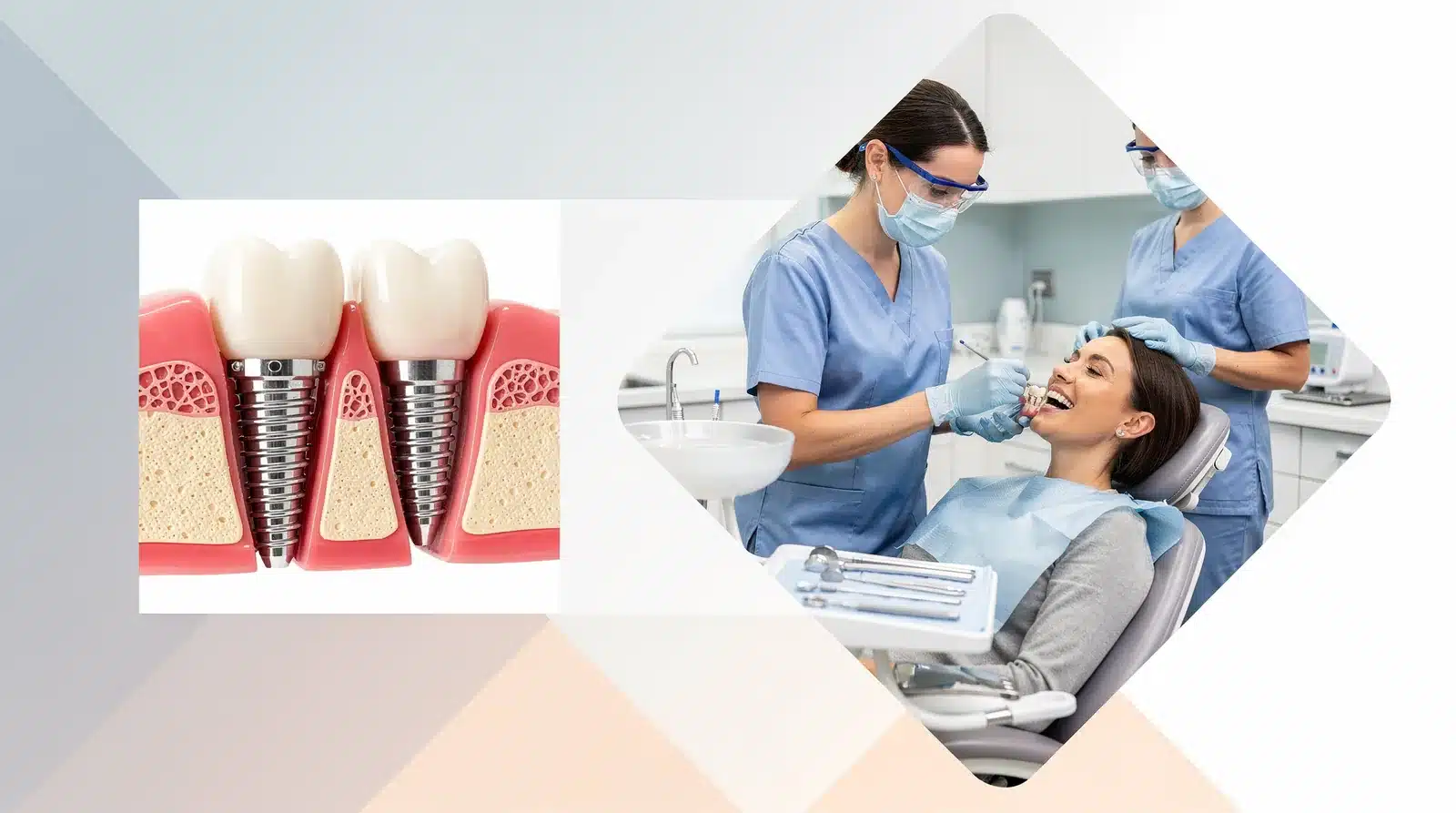 Poor implant hygiene can lead to peri-implantitis, an inflammatory condition that causes bone loss around