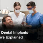 The All-on-4 Dental Implants Procedure is a permanently fixed full-arch dental prosthesis that uses four