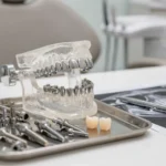 What factors affect dental implant cost