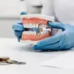 What is the dental implant cost per tooth