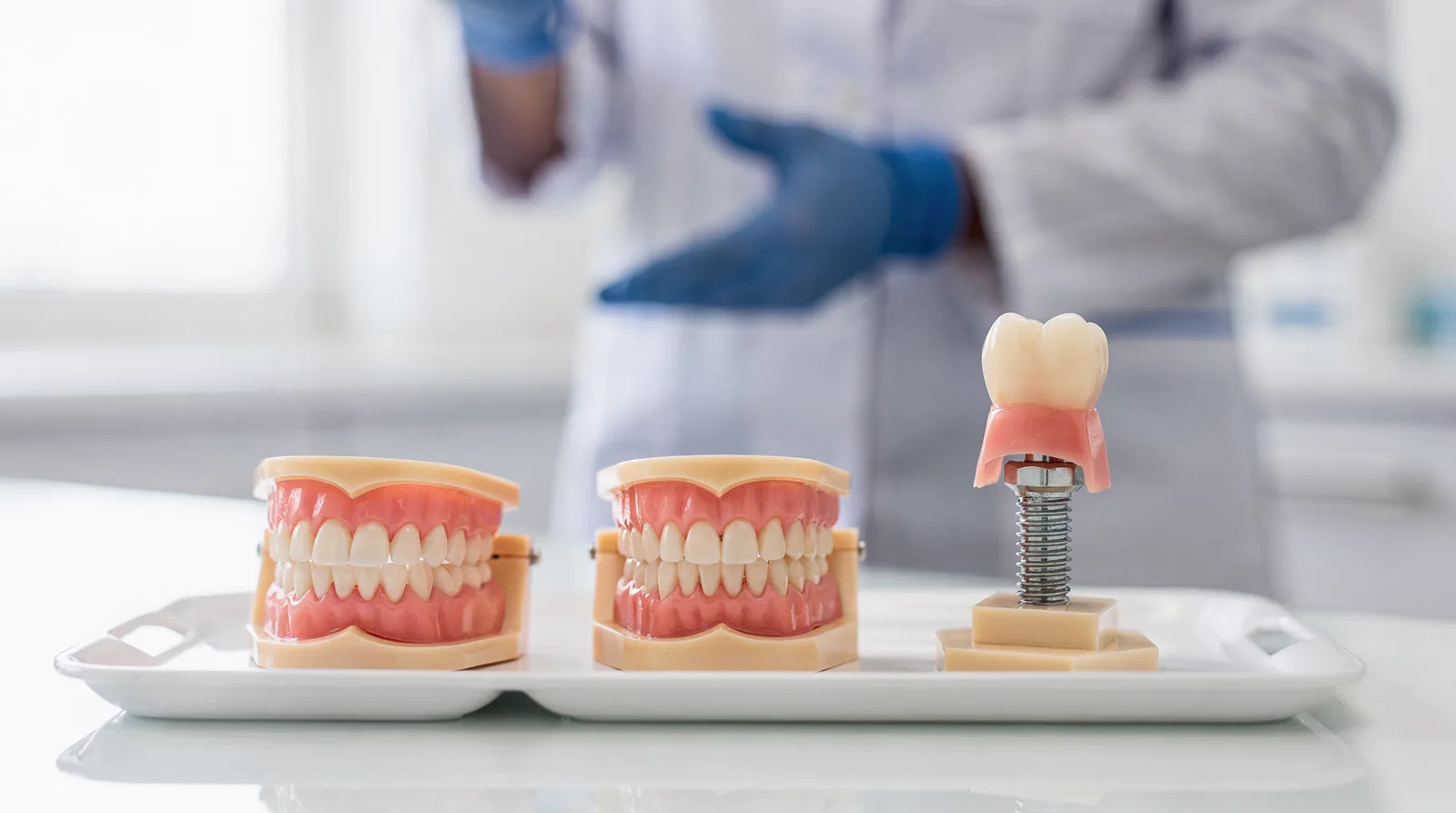 How do implants compare to dentures and bridges