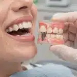 ¿Cómo los implantes dentales mejoran la salud bucal